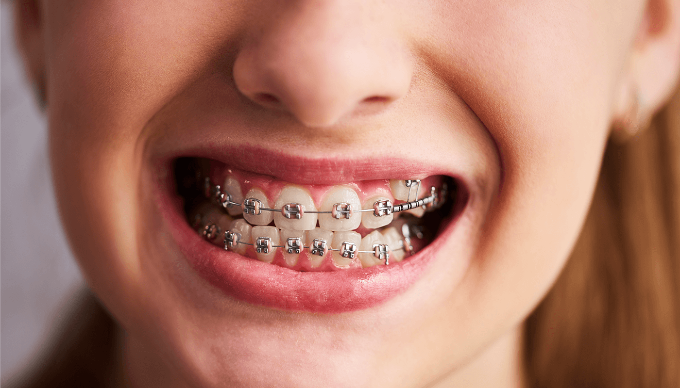 best-orthodontics-care-unit-department-at-mirus-critical-care-centre-lucknow