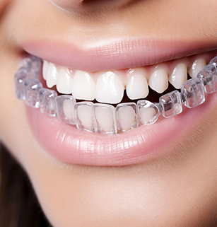 orthodontics-surgery-department-unit-at-mirus-critical-care-centre-lucknow